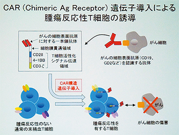 CAR-T 細胞療法のイメージ図（出典：講演資料より）