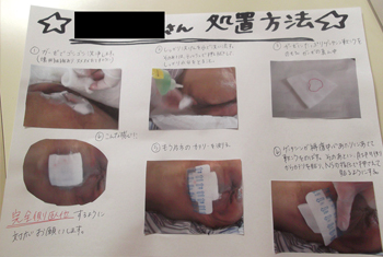 スタッフ間で処置方法を共有しケアを統一