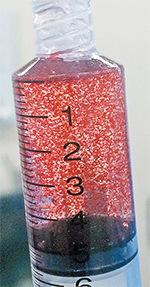 ビーズ製剤に抗がん剤を含ませ、腫瘍近くに注入